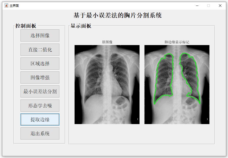 提取邊緣.JPG